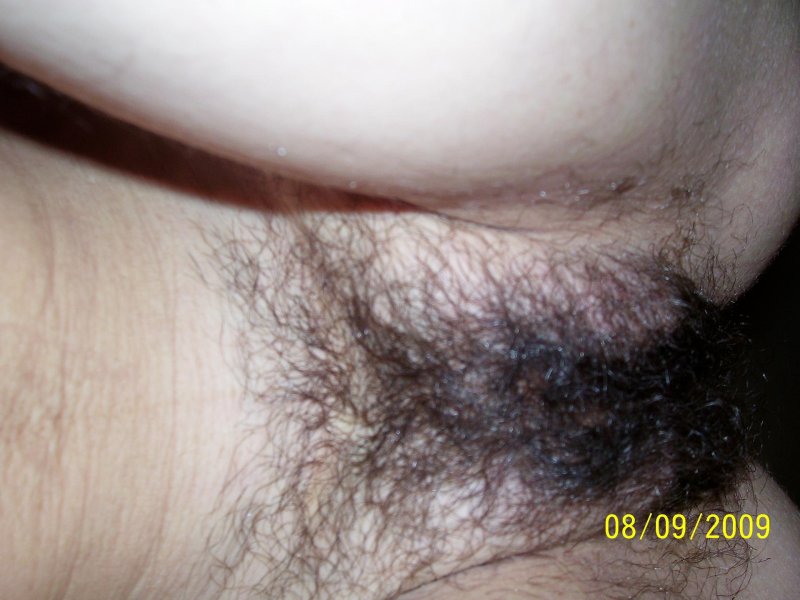 Hairy cancer