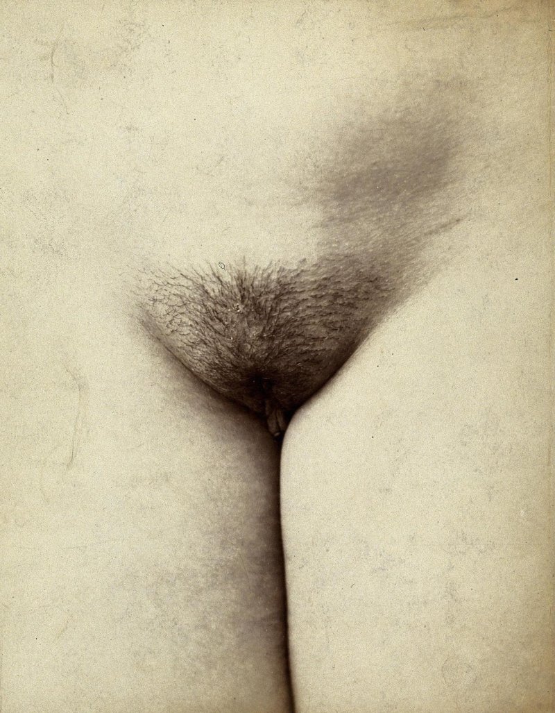 Explification of female pubis