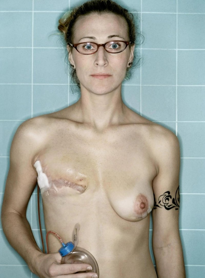 Naked women with cut off boobs