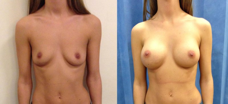Naked boobs in different directions
