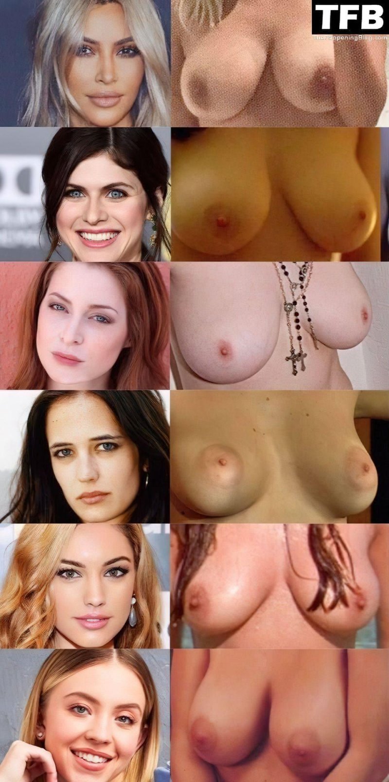 Mammoplasty Scarlett Johansson