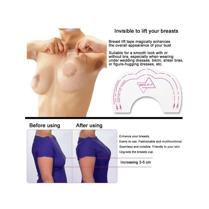 Breast lift