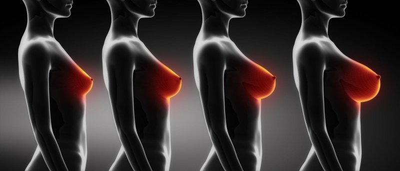 Female breasts