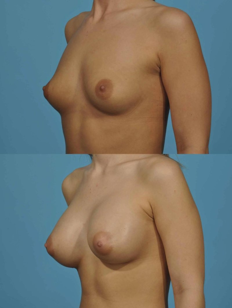 Breast Perthtat Girl Ero
