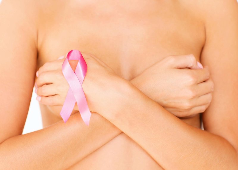 Prevention of breast cancer